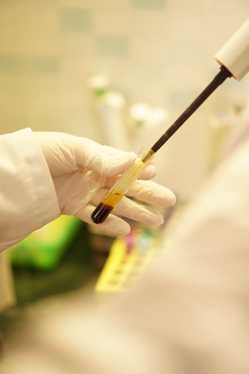 Phase-3-Sieg bei Melanom-Vakzin: Merck und Moderna liefern den Datenpunkt, auf den die Onkologie-Story gewartet hat